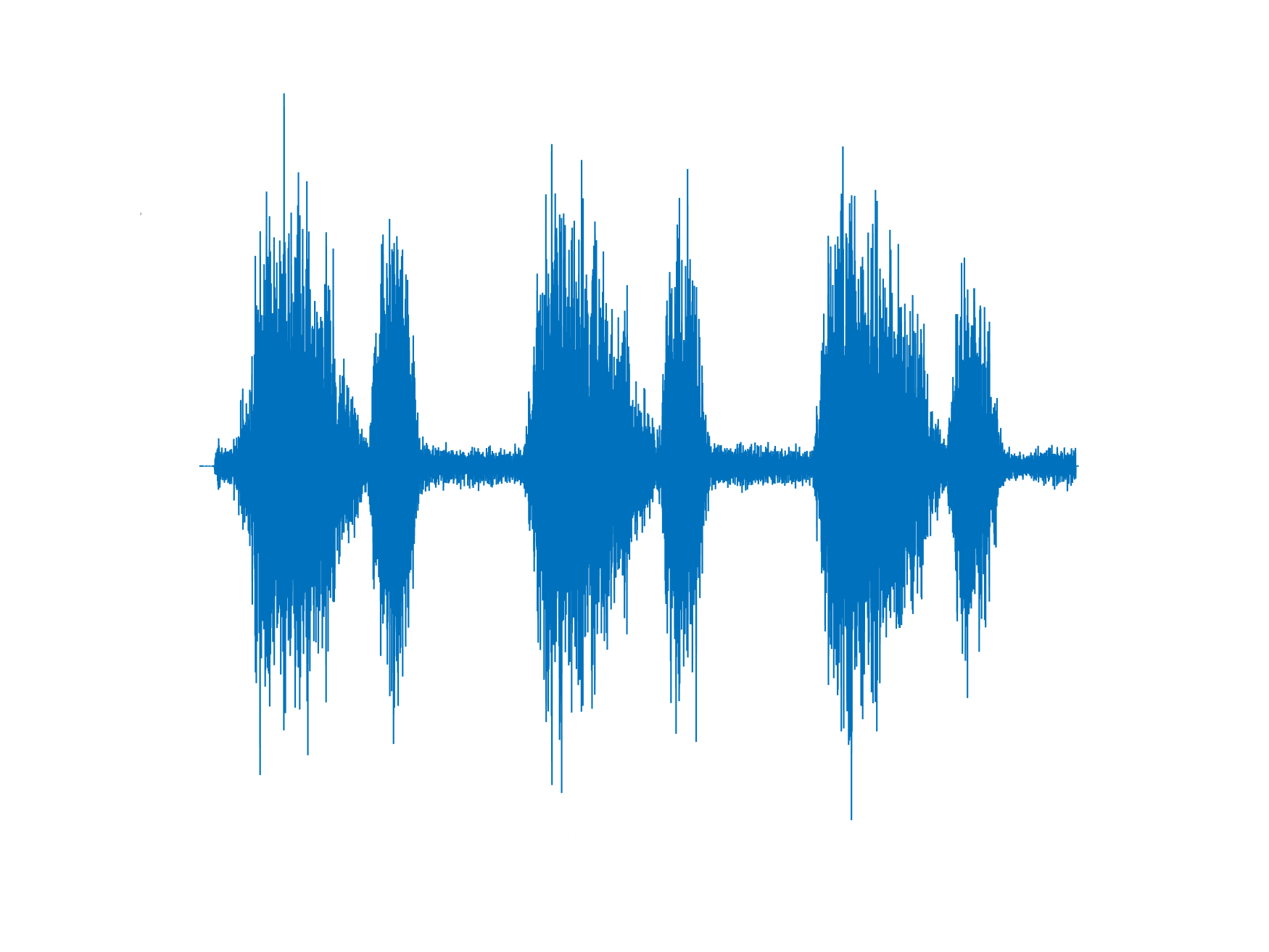 صداهای طبیعی ریه - وزیکولار (Vesicular) نرمال